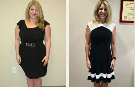 Before and after woman in a black dress