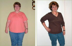 Glenda Before and After Weight Loss image