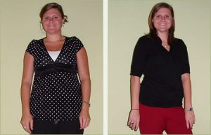 Lauren Before and After Weight Loss image