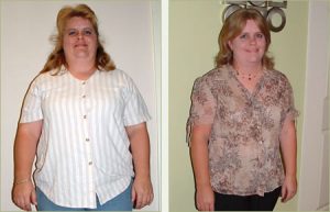 Lisa,H Before and After Weight Loss image