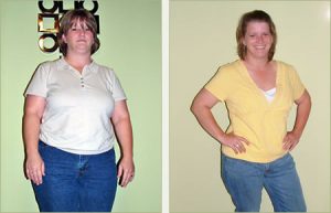 Missy Before and After Weight Loss image