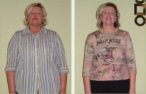 Pam Before and After Weight Loss image