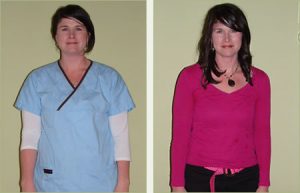 Rhonda Before and After Weight Loss image